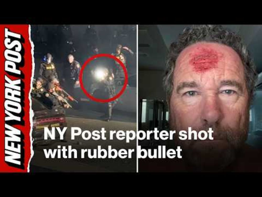 NY Post reporter shot in forehead with rubber bullet while covering LA riots
