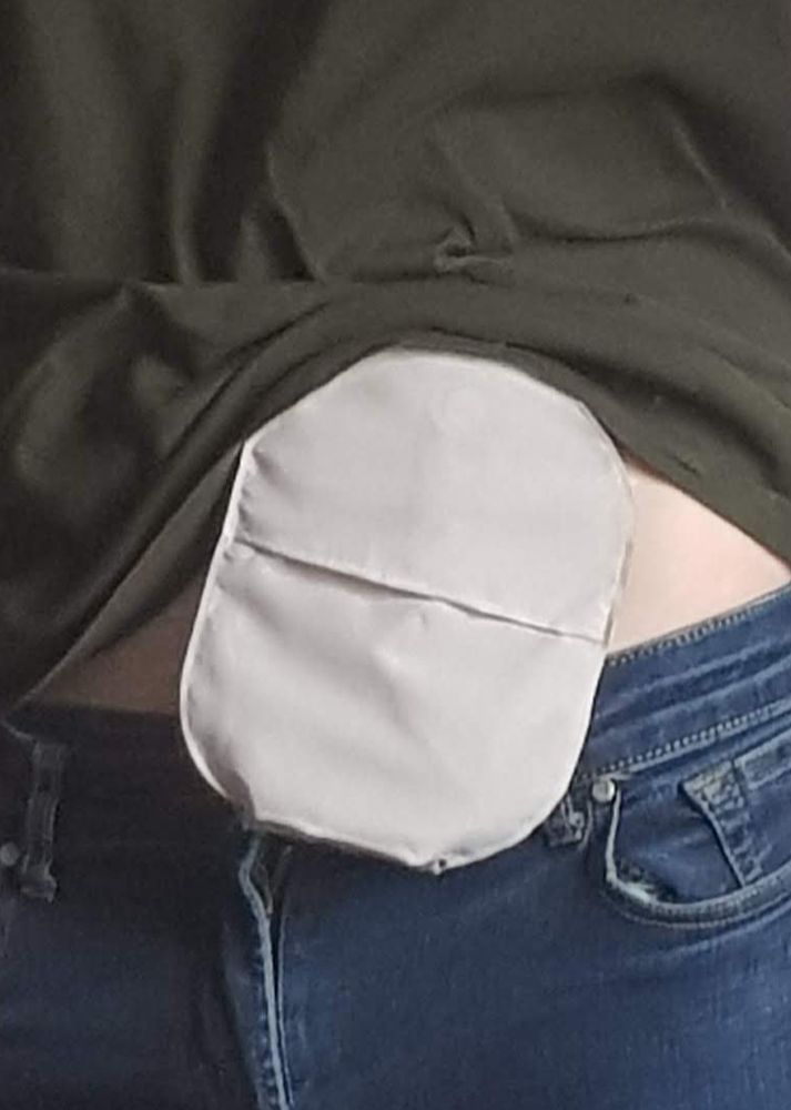 stoma bag