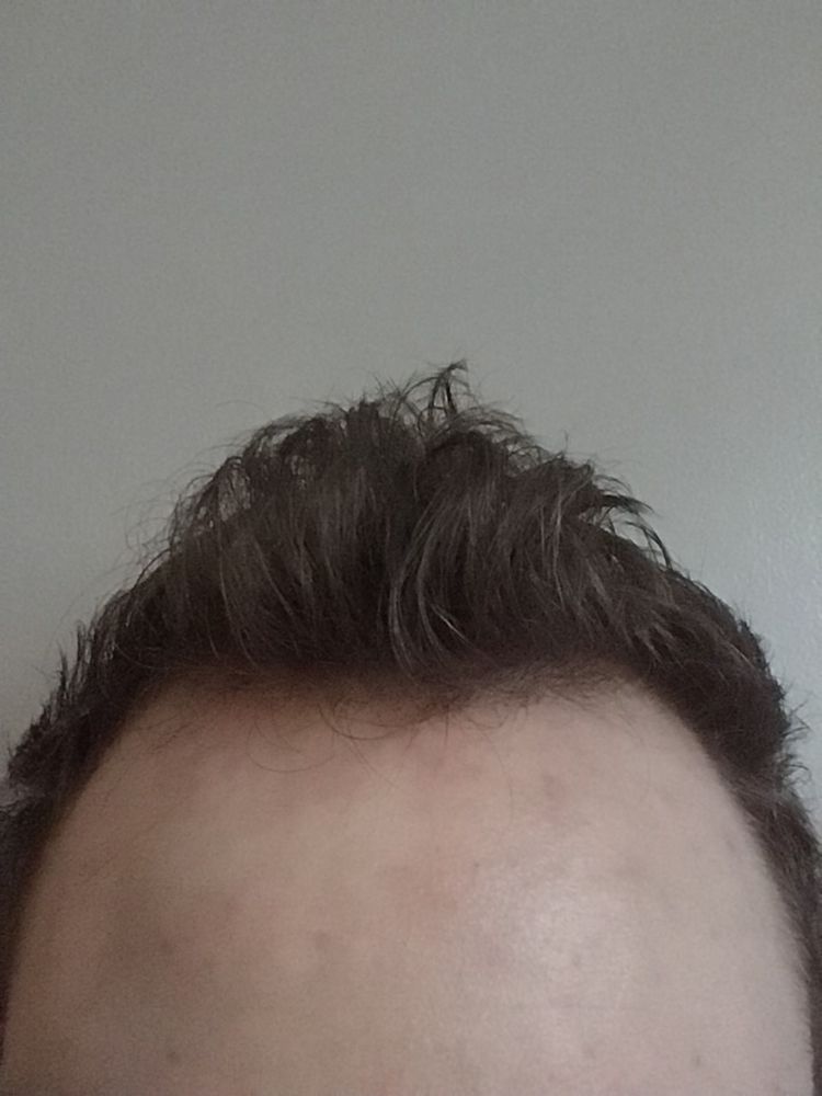 My hair in its natural state