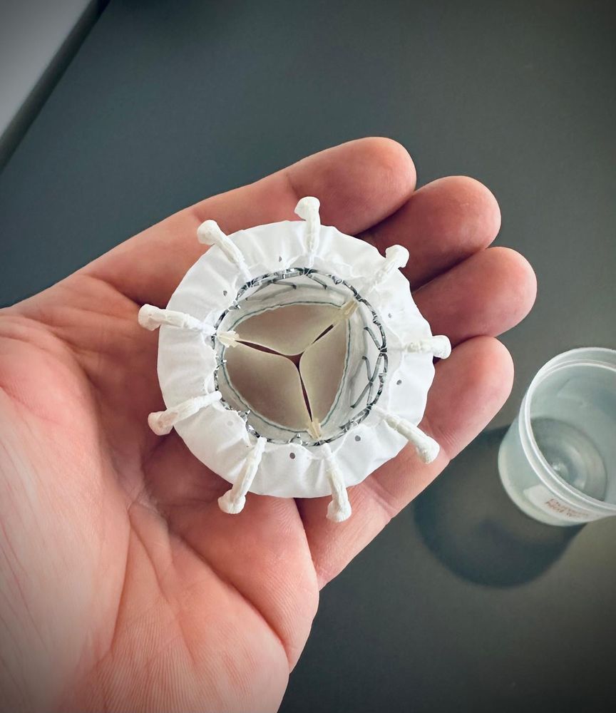 A prosthetic heart valve for the tricuspid position. 