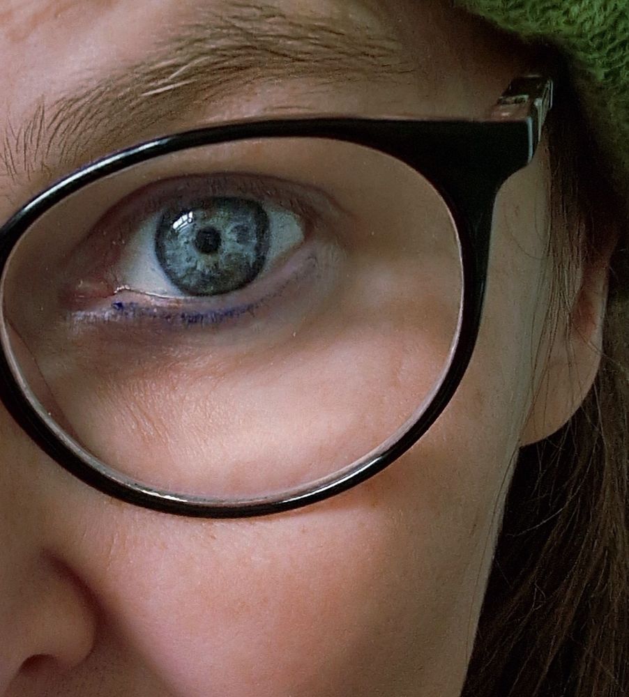 Ein blaues Auge 