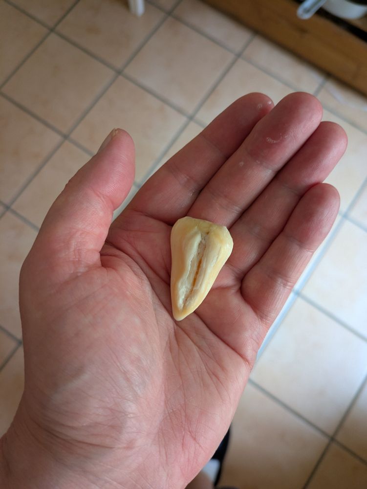 Hihi je fais croire que c'est une dent dans ma main mais en fait c'est un vieux  bout de savon