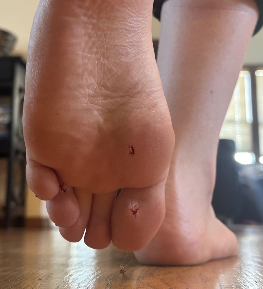 Three little men are crushed and adhered to the sole of Ruby. One little man stares up in horror at the massacre, and knows he too will soon be crushed without mercy.