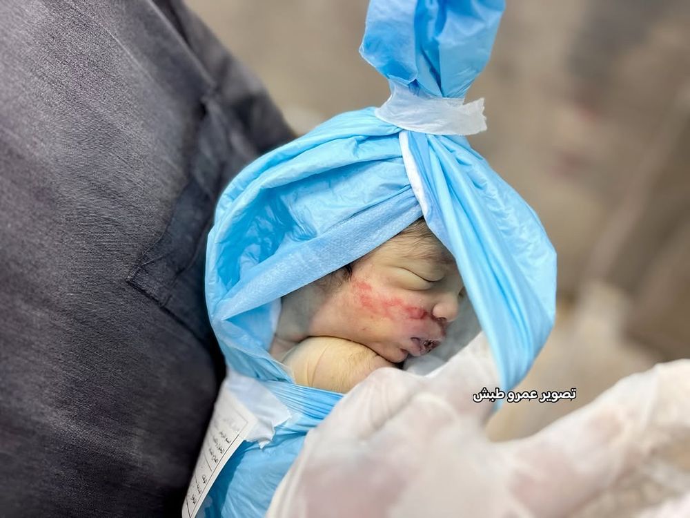 baby killed by zionists 