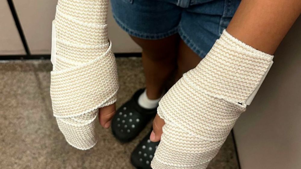 Texas middle school cheerleaders suffer first and second degree burns after ‘punishment’ from coach