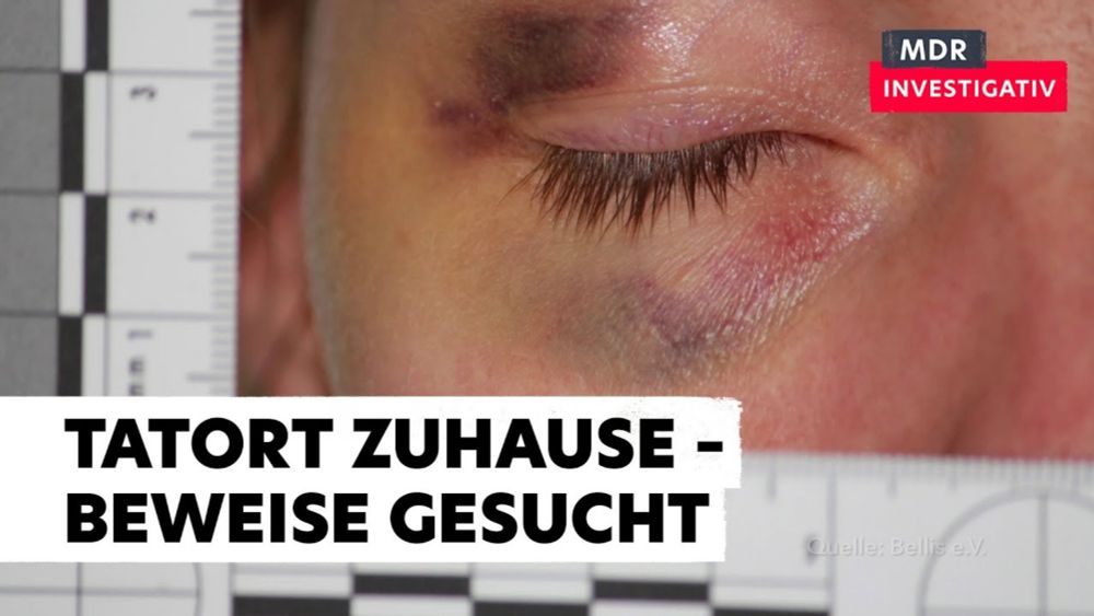 Gewalt gegen Frauen – gerichtsfeste Spurensicherung im Krankenhaus ohne Polizei