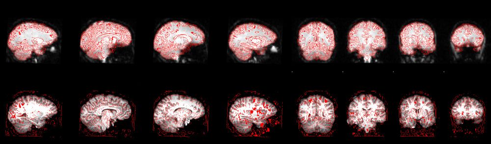 FMRI data processing was carried out using FEAT