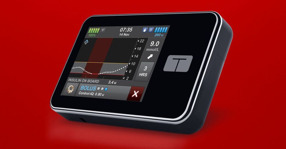 t:connect iOS app for insulin pump could kill users, says FDA - 9to5Mac