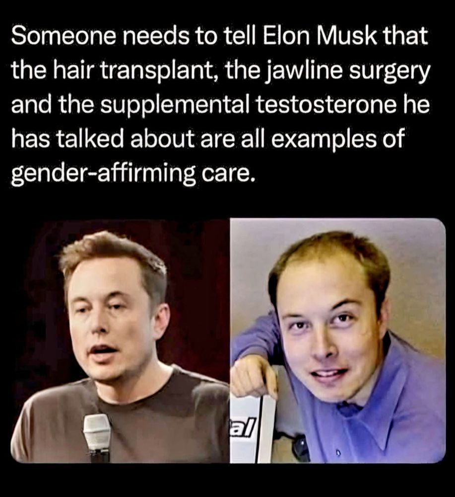 Before and after photos of Elon Musk. Text: Someone needs to tell Elon Musk that the hair transplant, the jawline surgery, and the supplemental testosterone he has talked about are all examples of gender-affirming care.