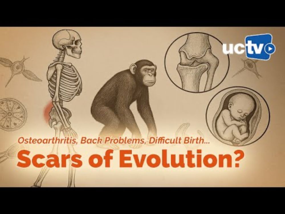 CARTA: Osteoarthritis, Back Problems, Difficult Birth - Scars of Our Evolution?
