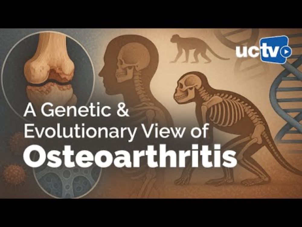CARTA: Risks of Human Skeletal Disease, Specifically, Osteoarthritis
