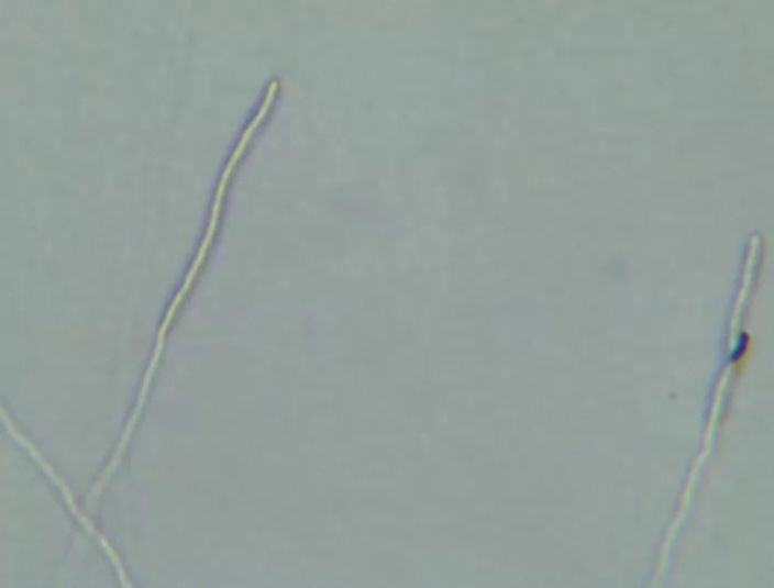 Fungus.