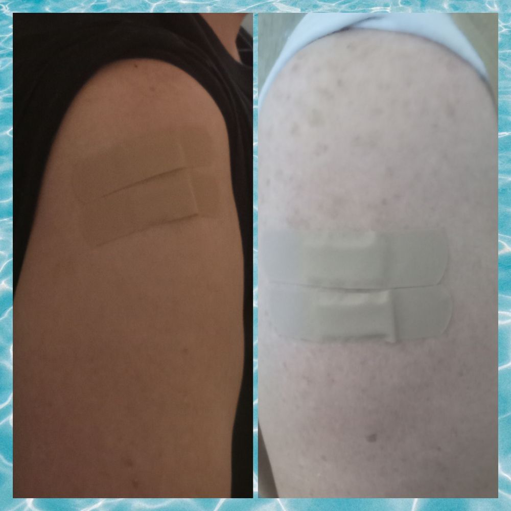 Couple senor citizens showing the bandaid from which they got flu vaccine and covid vaccine 