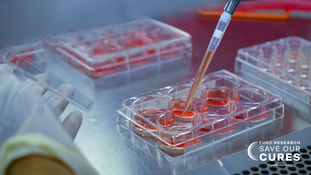 A laboratory scene showing a researcher using a pipette to transfer a red liquid into a tray of samples. The image includes a banner reading "FUND RESEARCH SAVE OUR CURES."