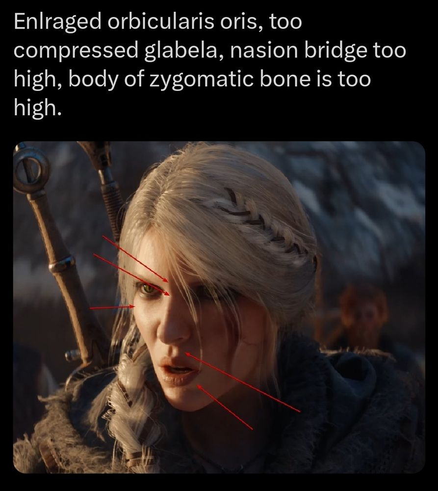 Some guy doing weird phrenology on the protagonist in the witcher 4