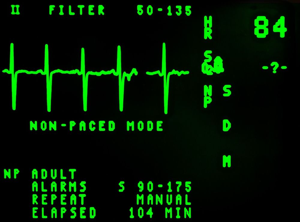 Can Pulse Diagnosis Really Diagnose Health Issues? - Rocky Mountain Atheists