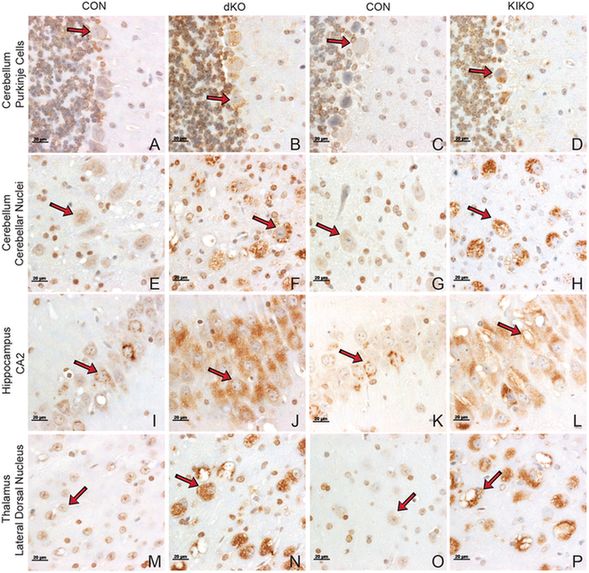 Immunohistochemical detection of GM2 ganglioside in dKO, KIKO and CON brains. Sections were selected from similar areas of the brain for matched pairs. Sections for each matched pair were stained together and photographed at 63× using a Zeiss Axioimager equipped with ZEN software. Many images are taken from within the same field of view as the 20× images shown in Fig. S6A. Specifically, data in Fig. 6, panels E,F,G,I,J,N, and O are also shown in Fig. S6A, panels A,B,C,I,J,N, and O respectively. The presence of a red-brown staining signal for GM2 ganglioside was present in CON brains but much more broadly and abundantly present in the sections from the dKO and KIKO brains. Arrows indicate cells that have low levels of GM2 in CON (A,C,E,F,I,K,M,O), compared to the higher levels of GM2 present in vacuolated cells (B,D,F,H,J,L,N,P). Arrows in panels A-D identify Purkinje cells. Scale bars: 20 µM. These images are representative of those from three different pairs of animals.
