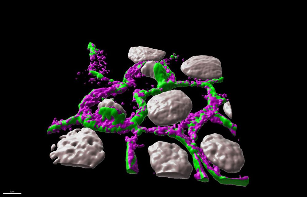The phosphorylated form of α-catenin localizes to the apical portion of adherens junctions. The image shows 3D surface rendering using Imaris software of a confocal image of a dividing kidney epithelial cell line (Madin–Darby canine kidney or MDCK cells). Phosphorylated α-catenin is shown in magenta and adherens junctions are in green.