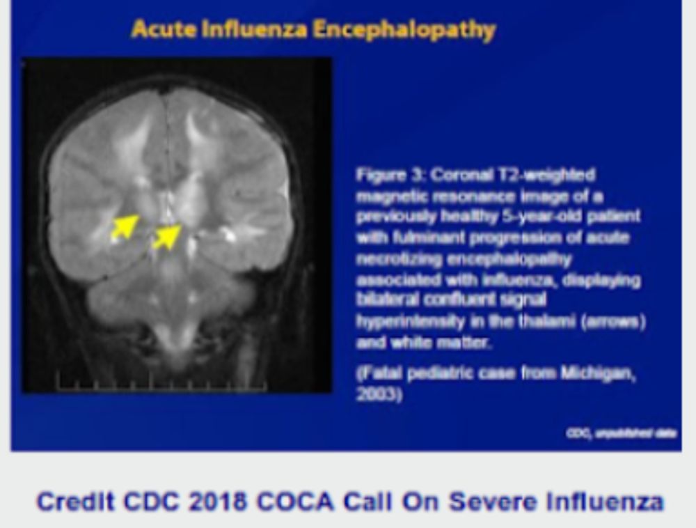 #18,836 For twenty years the influenza antiviral Tamiflu (oseltamivir) has carried a `black box warning ' regarding  potential neuropsychi...