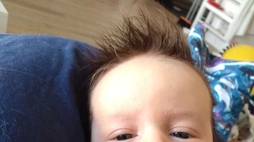 Foto da testa, olhinhos e cabelo em pé do meu bebê