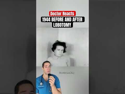 Doctor Reacts: lobotomy before and after
