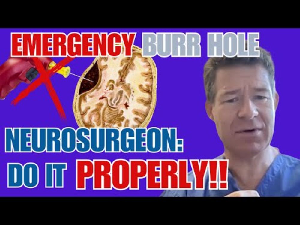 Extradural Hematoma Emergency: Right Equipment, Right Technique, Right Time