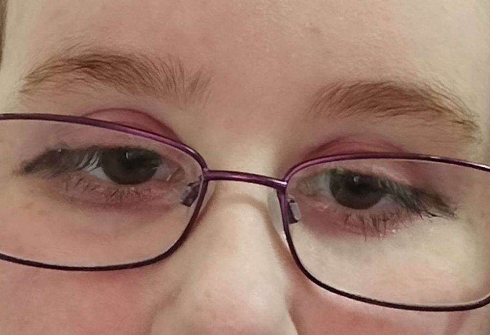 a closeup of my eyes wearing jirai style makeup
