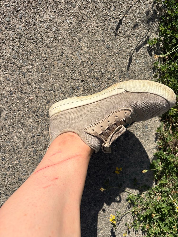 Bare ankle covered in scratches