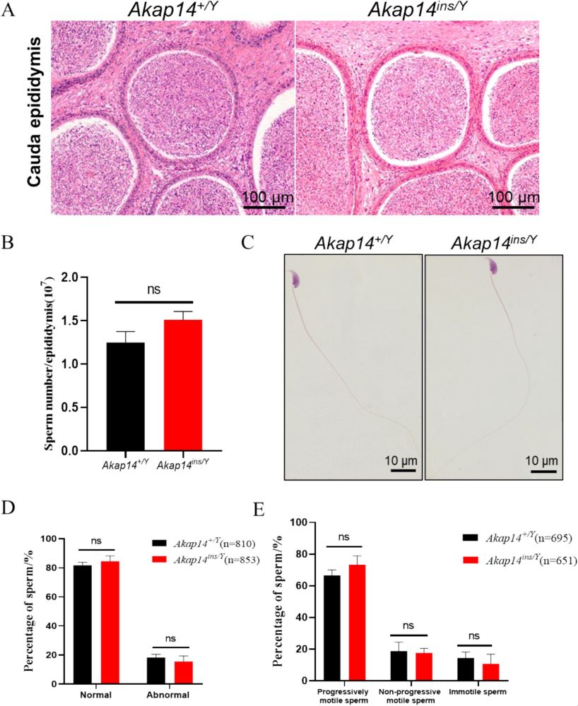Akap14ins/Y sperm counts, morphology and motility analysis.