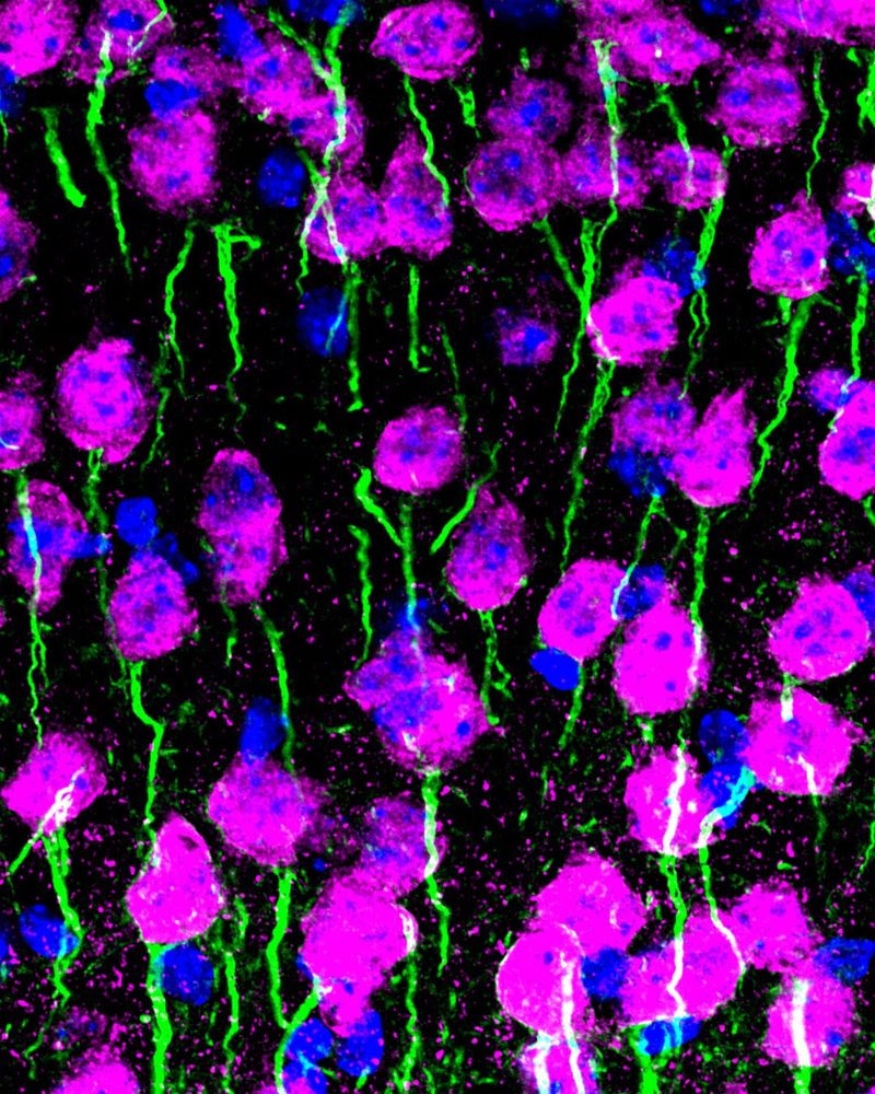 Cortex, brain. Neurons (NeuN, magenta), axon initial segments (Ankyrin-G, green), nuclei (DAPI, blue)

