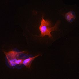 Neuromics primary human astrocytes stained with GFAP.