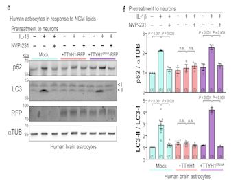 Neuromics primary human brain astrocytes used in a study to neuronal stress.