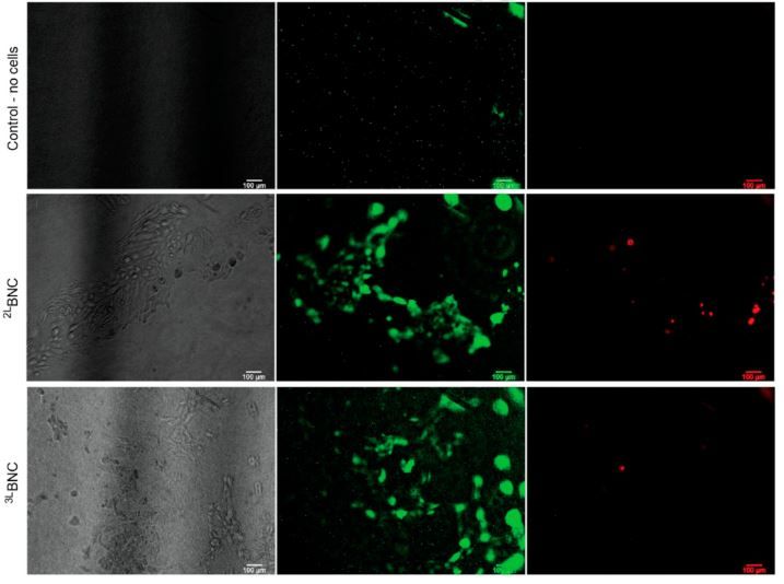EOMA cells grown with Neuromics’ FBS after one-week cell culture in BNC scaffolds.