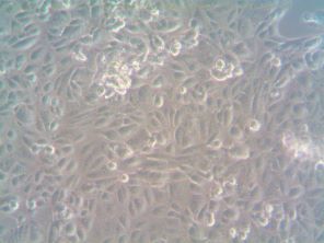 Neuromics human metastatic ovarian CAFs in culture.