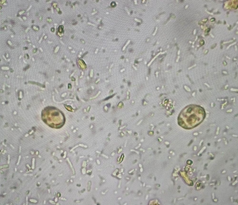 Blastocystis hominis