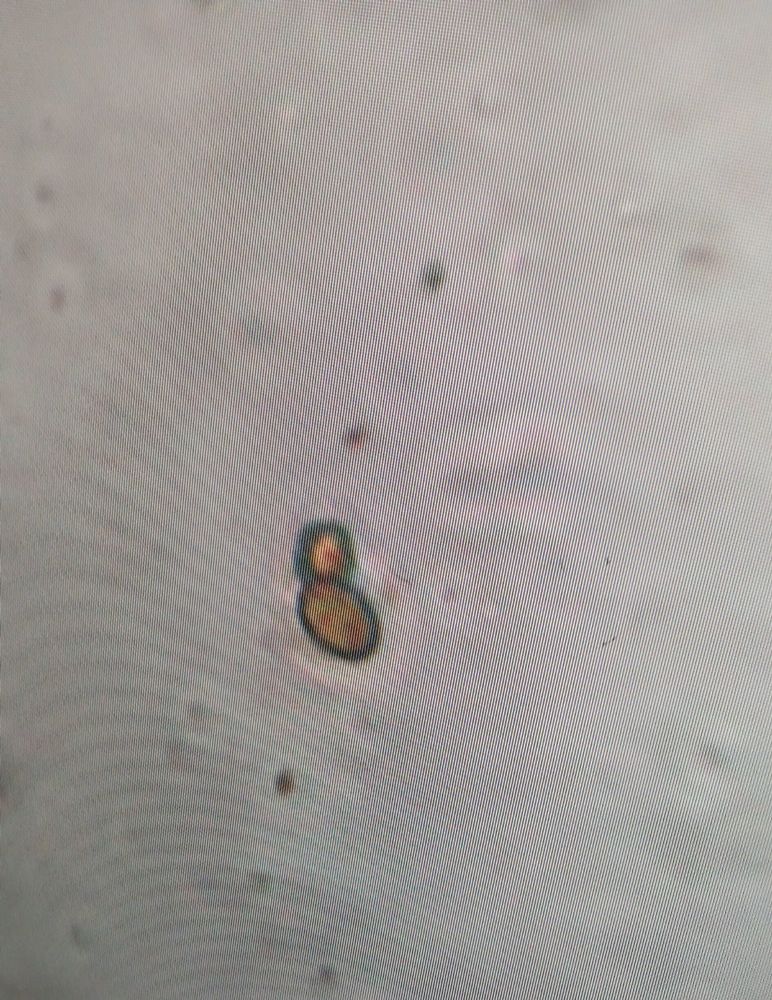 Yeast in gemmation (asexual reproduction)