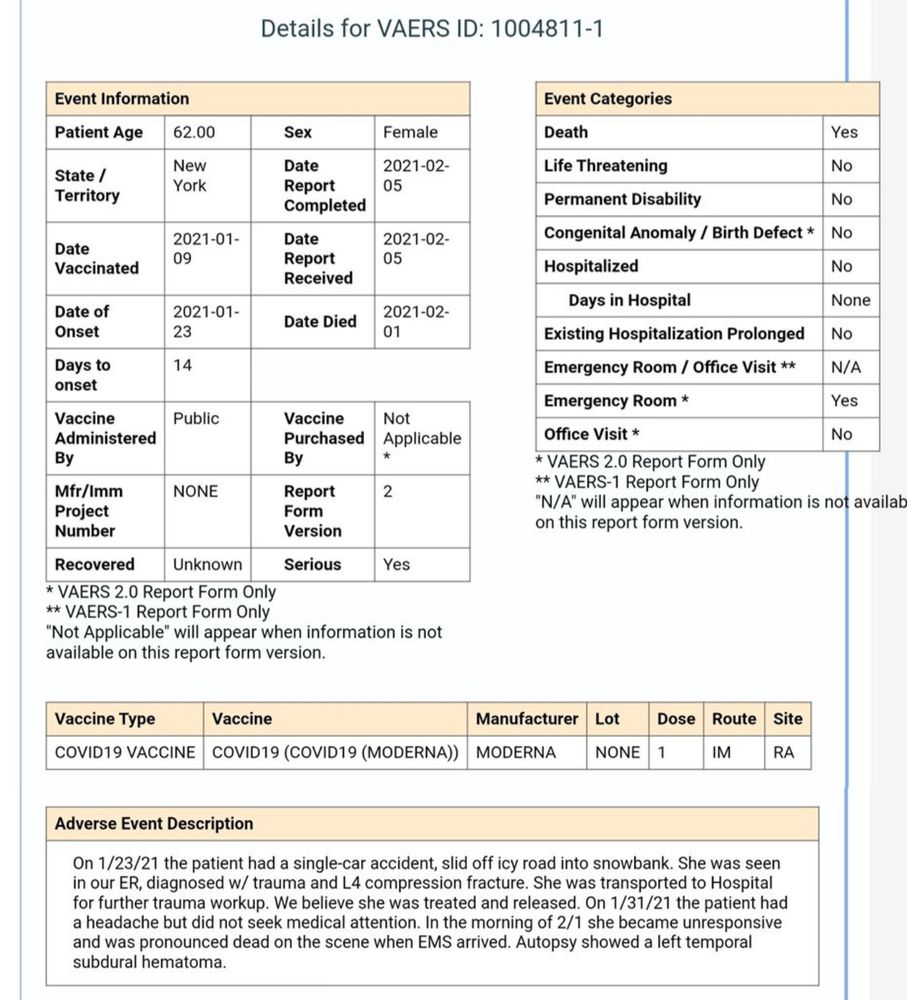 A VAERS report indicating death after COVID vaccine. The description of the investigation into this death reads:
Adverse Event Description
On 1/23/21 the patient had a single-car accident, slid off icy road into snowbank. She was seen in our ER, diagnosed w/ trauma and L4 compression fracture. She was transported to Hospital for further trauma workup. We believe she was treated and released. On 1/31/21 the patient had a headache but did not seek medical attention. In the morning of 2/1 she became unresponsive and was pronounced dead on the scene when EMS arrived. Autopsy showed a left temporal subdural hematoma.