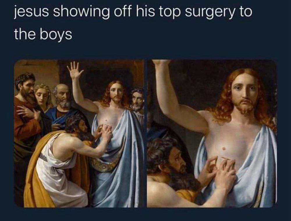 The photo shows Jesus with a wound under his chest. And there is text saying: “jesus showing off his top surgery to the boys”