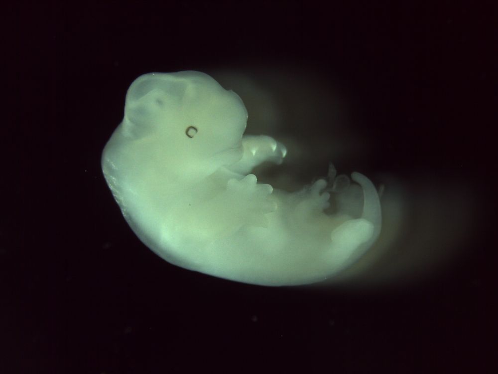 The arms and heads of opossums (pictured here one day before birth ) and other marsupials develop faster than their legs and back bodies. 
Image credit: Sergio Menchero Fernandez/ Francis Crick Institute, London.
