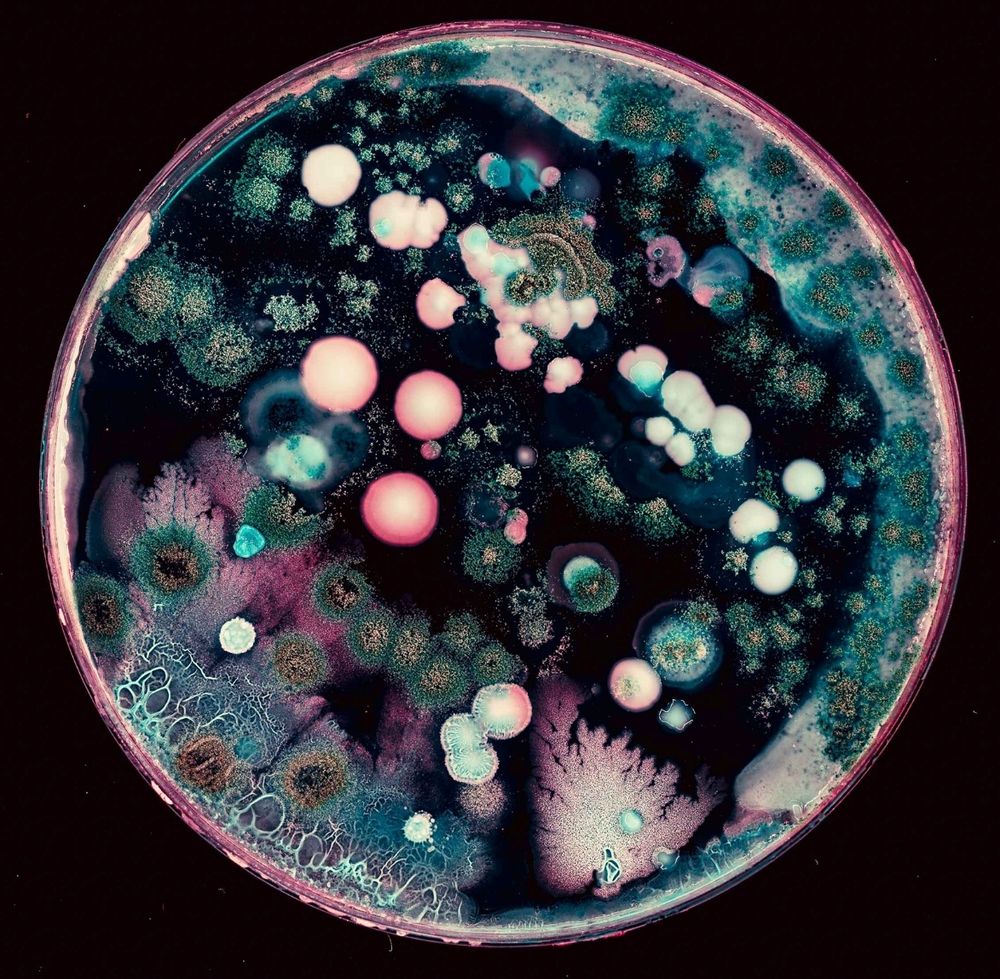 Microorganisms viewed through a microscope.
Image credit: Shutterstock/luchschenF.
