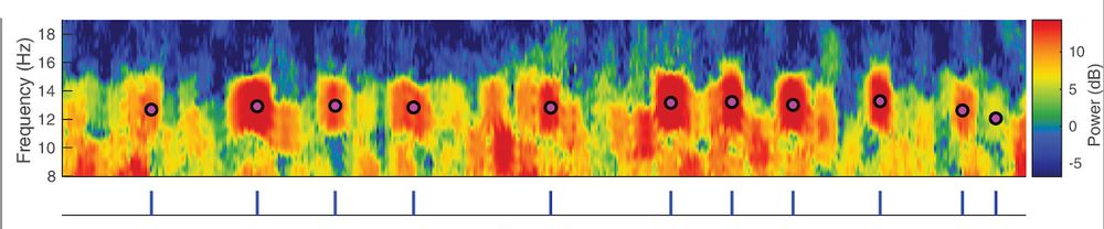 EEG multitaper spectrogram with circles indicating detected spindles.