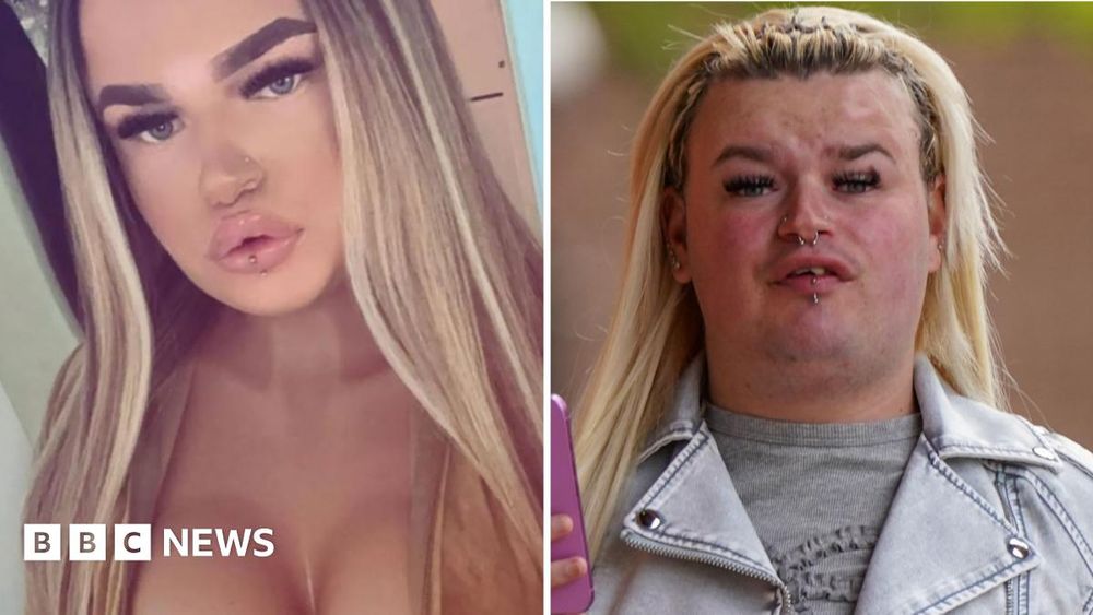 Ciara Watkin lied about being a biological female when the pair had a sexual liaison, a court hears.