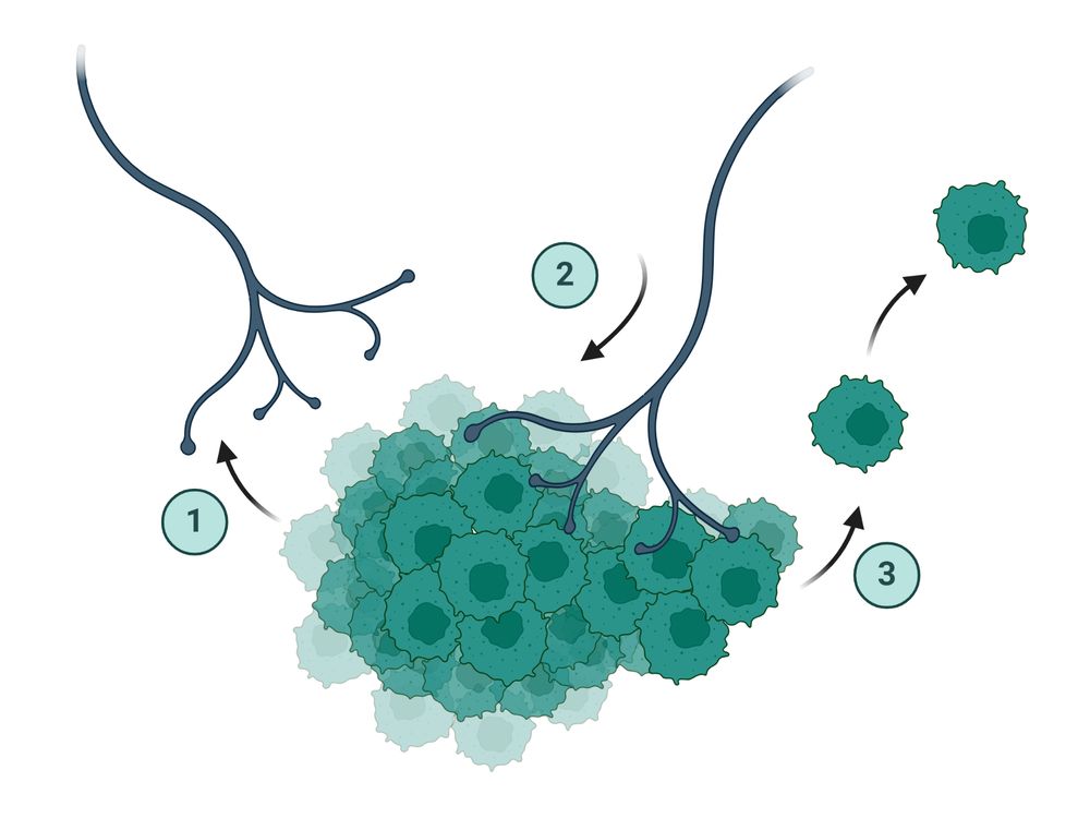 Breast Tumors Recruit Nearby Nerves to Fuel Metastasis