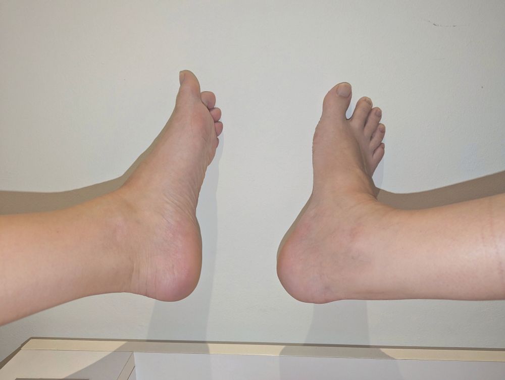 Feet and soles