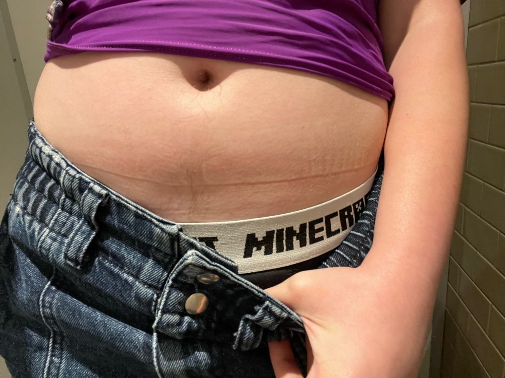 Me pulling my jeans down so you can see my Minecraft boxers :)