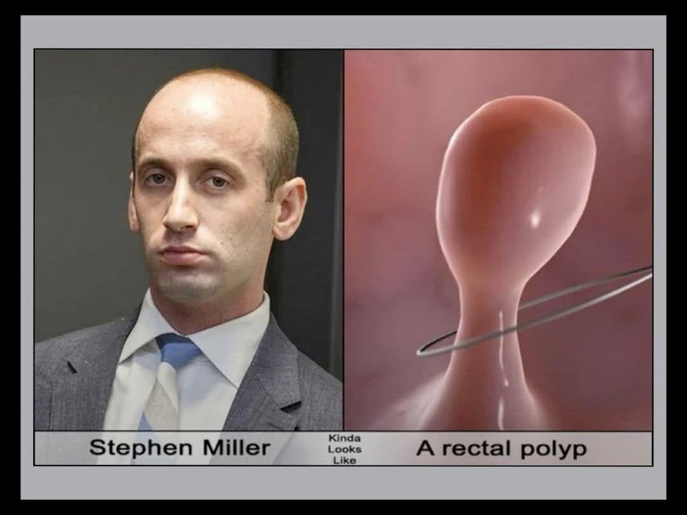 REMOVE THE POLYP!!
