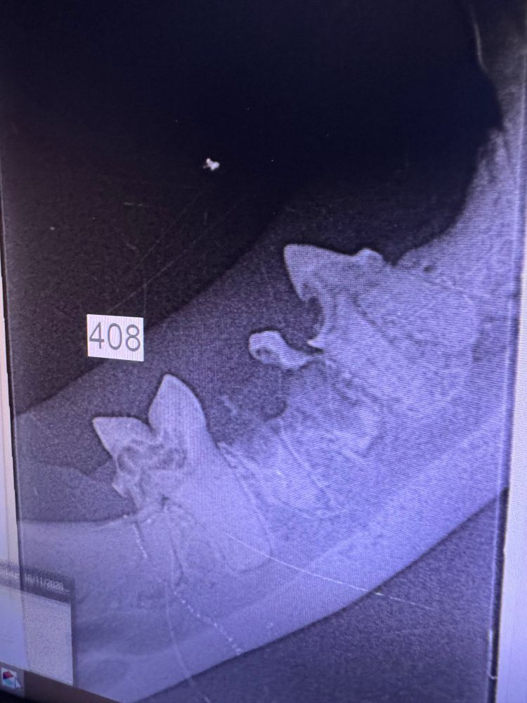 Xray of damaged teeth 