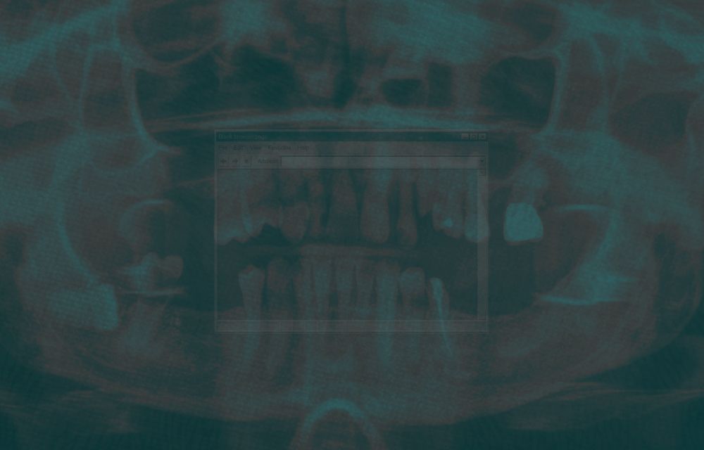 Photomontage d'une radio dentaire avec un jeu de transparence les couleurs bleu/vert/rouge ainsi qu'une fenêtre windows 95/Photomontage of a dental x-ray, a play of transparency with the blue/green/red colors and a Windows 95's window screen