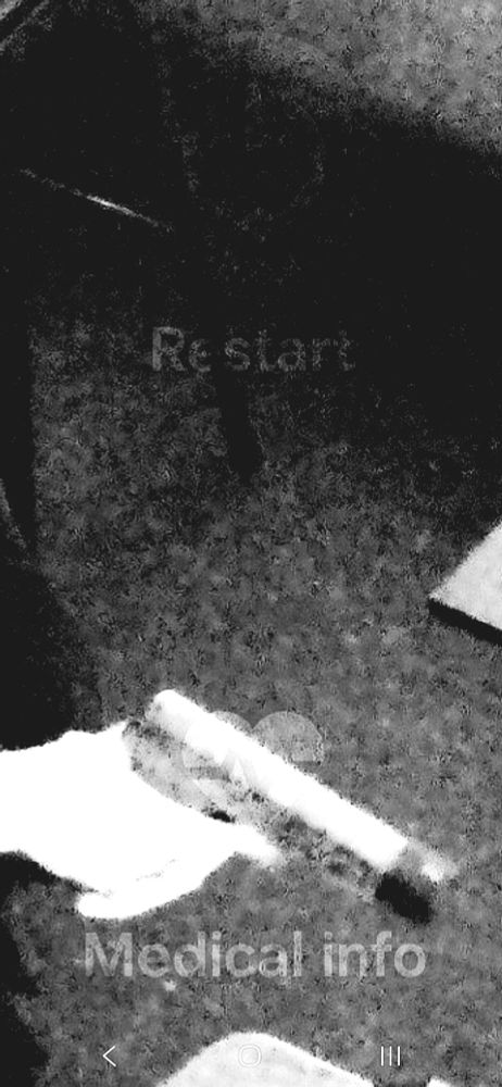 A zoom in of the above image showing the words "Restart" and "Medical info" overlayed with their respective symbols.