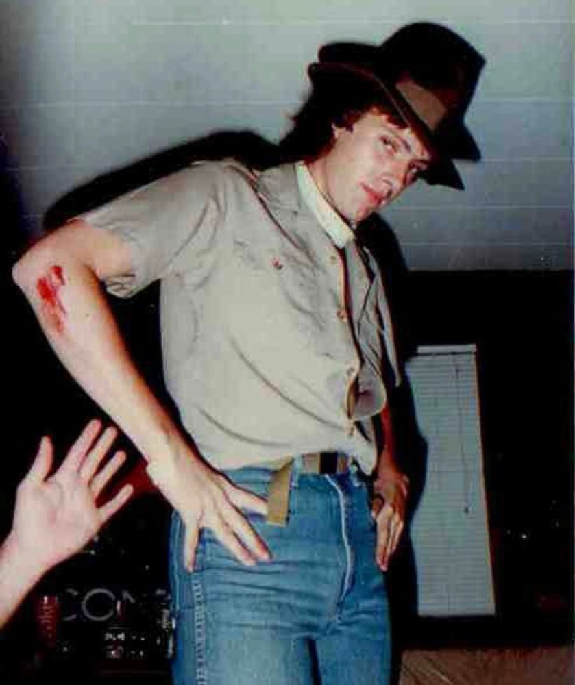 Man in a hat stands with hands on hips with a cut on his right arm 